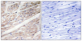 c-Kit (phospho-Tyr936) antibody