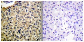 c-Kit (phospho Tyr703) rabbit pAb