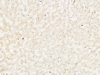 Arginase I rabbit pAb