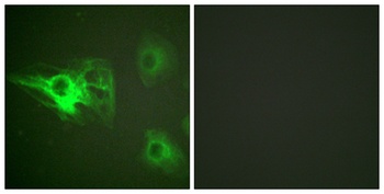 Cytokeratin 8 (phospho-Ser432) antibody