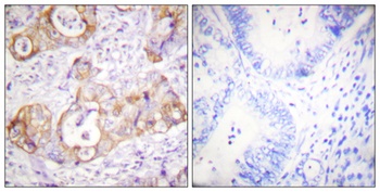 Cytokeratin 8 (phospho Ser432) rabbit pAb