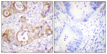 Cytokeratin 8 (phospho-Ser432) antibody