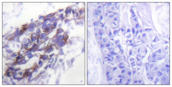 Cytokeratin 8 rabbit pAb