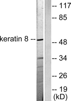 Cytokeratin 8 rabbit pAb