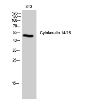 Cytokeratin 14/16 rabbit pAb
