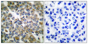 Cytokeratin 14/16 rabbit pAb