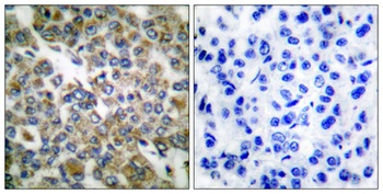 Cytokeratin 14/16 antibody