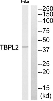 TBPL2 rabbit pAb