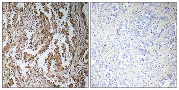 TBPL2 antibody