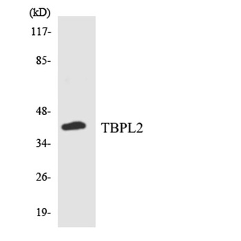 TBPL2 rabbit pAb