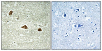 Cytokeratin 18 (phospho Ser52) rabbit pAb