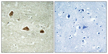 Cytokeratin 18 (phospho-Ser52) antibody