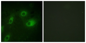 Cytokeratin 18 (phospho-Ser52) antibody