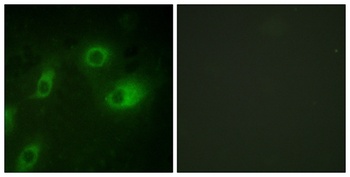 Cytokeratin 18 (phospho Ser52) rabbit pAb