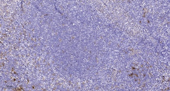 NCAM-L1 (phospho Ser1181) rabbit pAb
