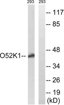 Olfactory receptor 52K1 antibody