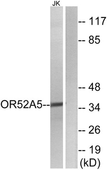 Olfactory receptor 52A5 rabbit pAb
