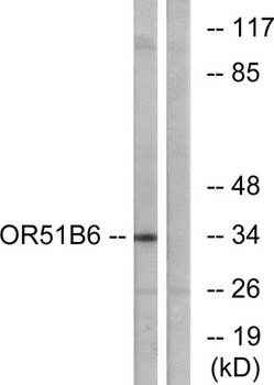Olfactory receptor 51B6 rabbit pAb