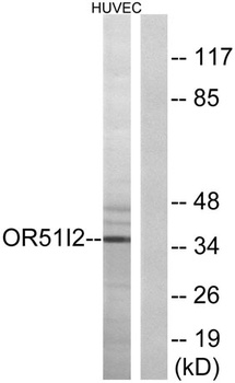 Olfactory receptor 51I2 rabbit pAb
