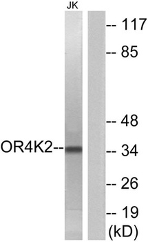 Olfactory receptor 4K2 rabbit pAb Antibody