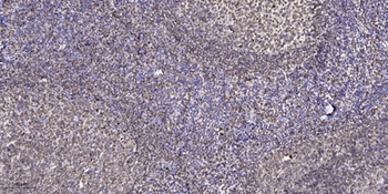 Rho G antibody