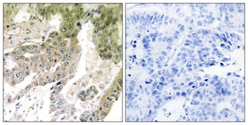 Laminin alpha-5 antibody