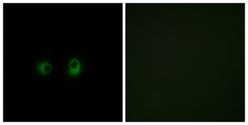 Olfactory receptor 2AK2 rabbit pAb Antibody