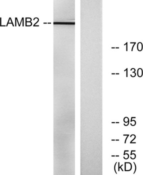 Laminin beta-2 antibody