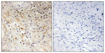 Laminin beta-3 antibody