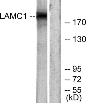 Laminin γ-1 rabbit pAb