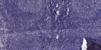 Laminin γ-1 rabbit pAb