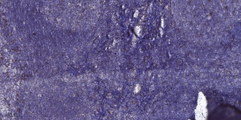 Laminin gamma-1 antibody