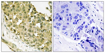 Op18 (phospho Ser62) rabbit pAb