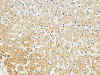 LBP antibody