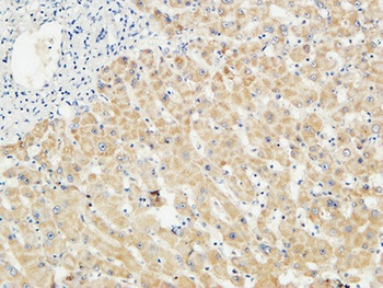 LBP antibody