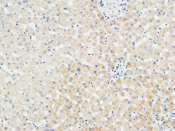 LBP antibody