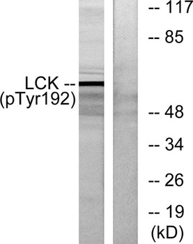 Lck (phospho Tyr192) rabbit pAb