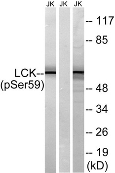 Lck (phospho Ser540) rabbit pAb