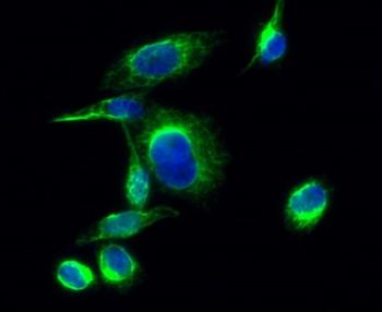Lck (phospho Tyr393) rabbit pAb