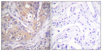 Lck (phospho-Tyr505) antibody