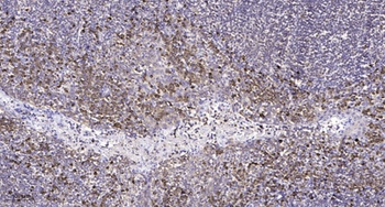 Lck antibody