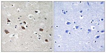 SLP-76 (phospho Tyr128) rabbit pAb
