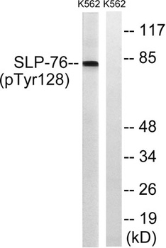 SLP-76 (phospho-Tyr128) antibody