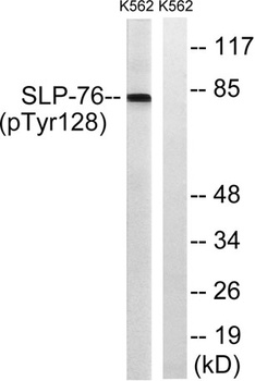 SLP-76 (phospho Tyr128) rabbit pAb