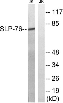 SLP-76 antibody