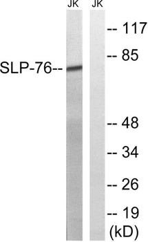 SLP-76 rabbit pAb