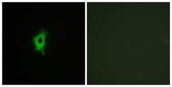 Galectin-2 rabbit pAb Antibody