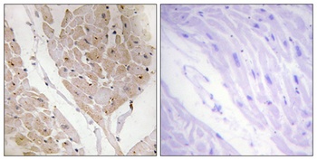 Galectin-2 rabbit pAb Antibody