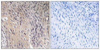 Rho GDIα (phospho Ser174) rabbit pAb
