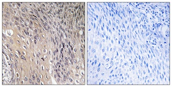 Rho GDIalpha (phospho-Ser174) antibody